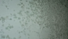 Hatékony módszerek a falpenész elleni küzdelemhez