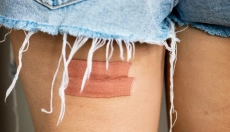 Hatékony és természetes módszerek gennyes sebek kezelésére