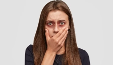 Hogyan kezeljük a zúzódásokat bevált természetes módszerekkel